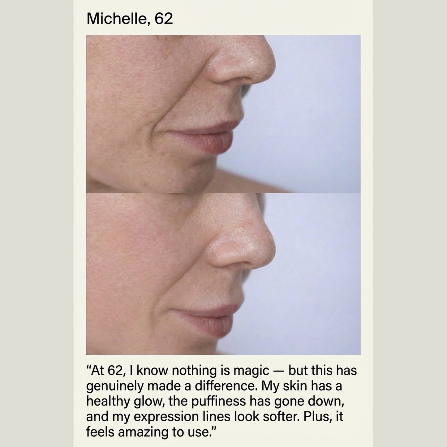 2-in-1 LED Red Light Therapy Skincare Device with EMS & Vibration