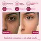 Korean Retinol & Vitamin C Anti-Aging Under Eye Pads - 5 Pairs