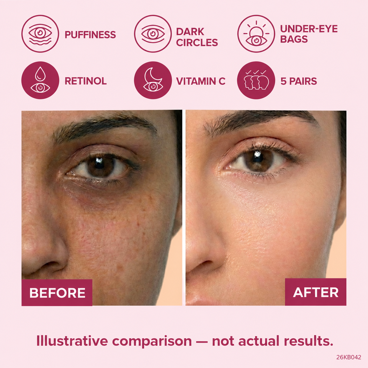 Korean Retinol & Vitamin C Anti-Aging Under Eye Pads - 5 Pairs