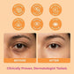 Lovery Korean Skincare Eye Roller Serum Duo - Collagen + Retinol & Vitamin C Brightening Under Eye Treatment Set