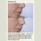 2-in-1 LED Red Light Therapy Skincare Device with EMS & Vibration