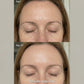 7-in-1 Advanced LED Skincare Renewal Wand